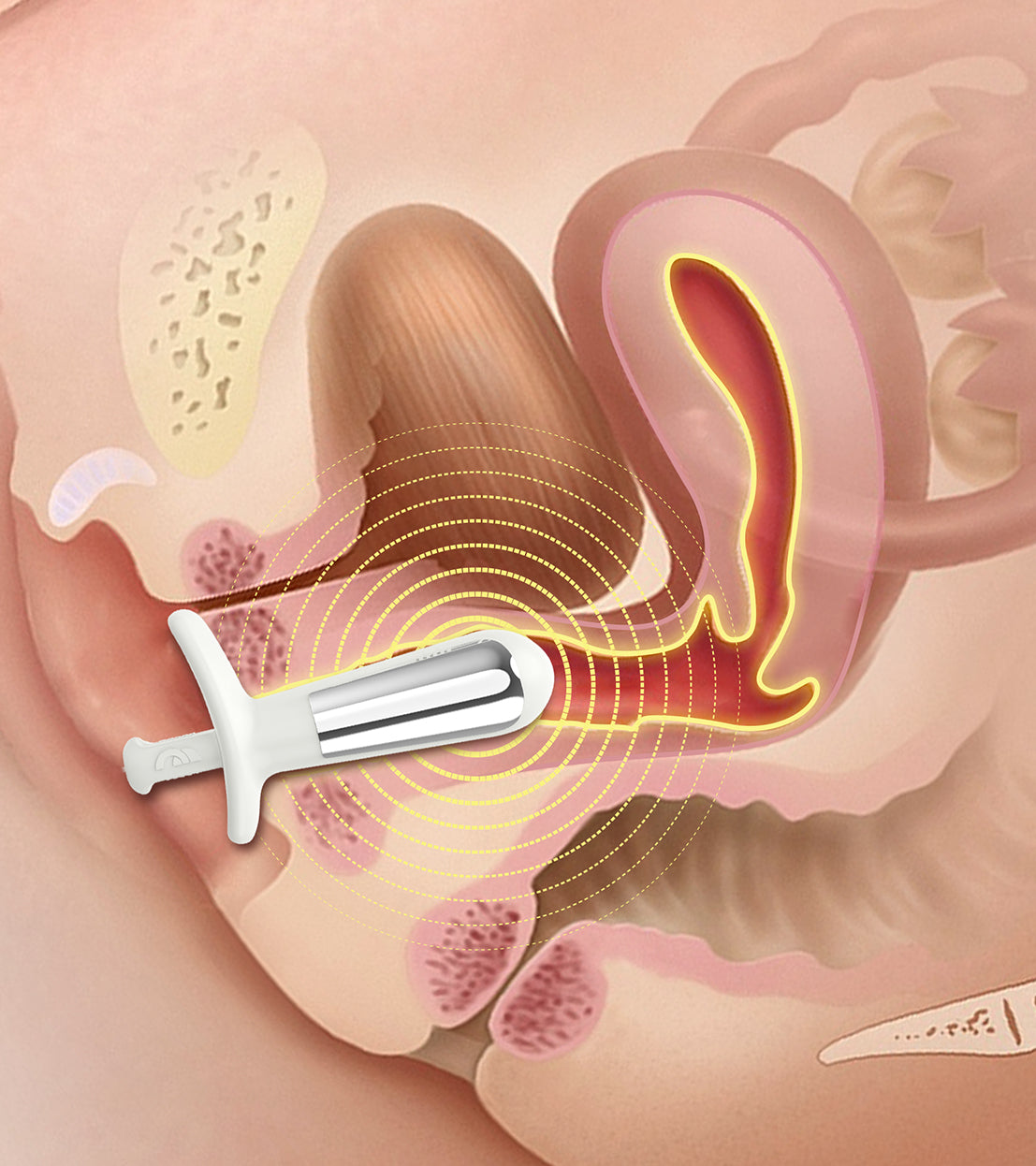 Healing Diastasis Recti: Pelvic Floor Technology for Core Restoration